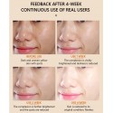 Ser pentru fata cu vitamina C - anti-pigmentare, Vibrant Glamour Vitamina C Face Serum 30 ml 
